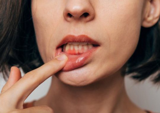 Lady shows inflamed gums