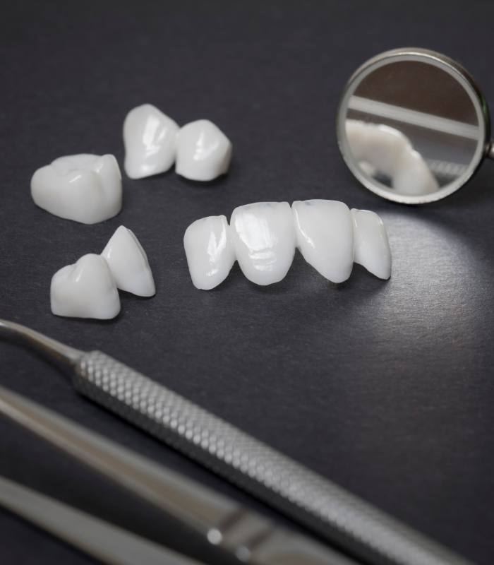 Several white dental crowns and veneers on table with dental instruments