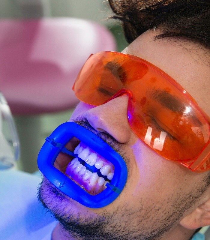 Man getting professional teeth whitening in dental chair