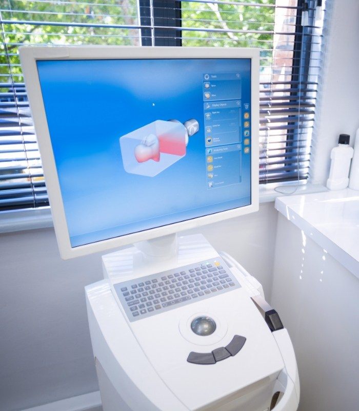 Digital model of a tooth on a computer monitor