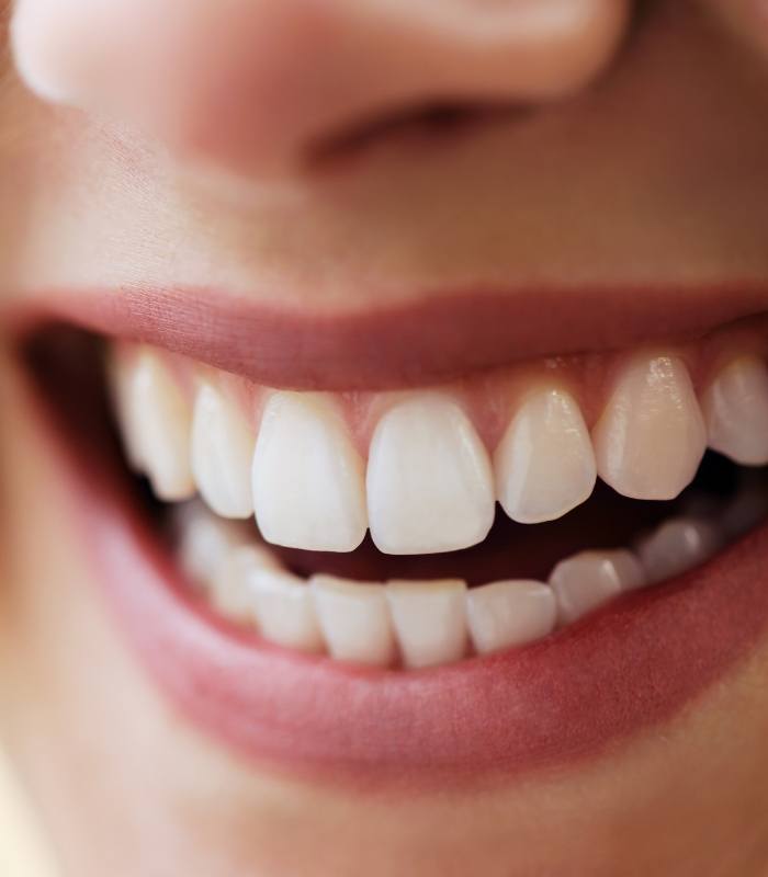 Close up of person smiling with straight white teeth