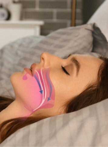 Sleep[ing woman with model of her airway illustrated