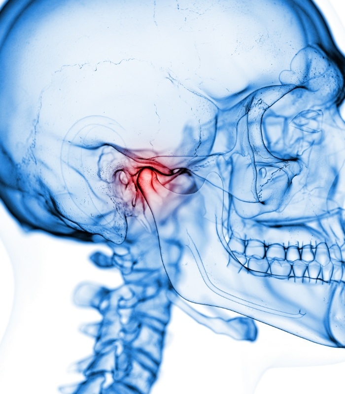 Side profile of the skull with T M J highlighted red