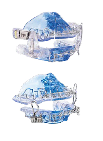 Blue and white oral appliance